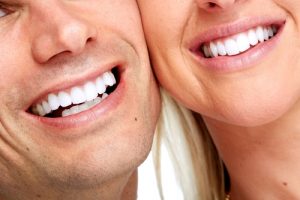 anderson-teeth-whitening