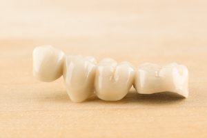 artificial dental structures made of ceramics for restoration of dentition